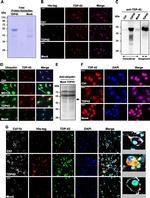 6x-His Tag Antibody in Immunocytochemistry (ICC/IF)