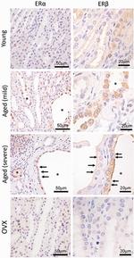 Estrogen Receptor beta Antibody in Immunohistochemistry (IHC)