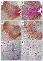 Galectin 3 Antibody in Immunohistochemistry (IHC)