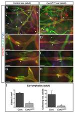 LYVE1 Antibody in Immunohistochemistry (IHC)