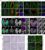 CD324 (E-Cadherin) Antibody in Immunohistochemistry (IHC)