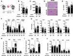 TNF alpha Antibody in ELISA (ELISA)