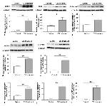 NFATC1 Antibody in Western Blot (WB)