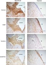 ADAMTS4 Antibody in Immunohistochemistry (IHC)