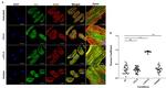 Alix Antibody in Immunocytochemistry (ICC/IF)