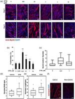 Myosin 4 Antibody in Immunocytochemistry (ICC/IF)