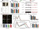 Synaptophysin Antibody in Immunocytochemistry, Immunohistochemistry (ICC/IF, IHC)