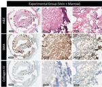 Alpha-Smooth Muscle Actin Antibody in Immunohistochemistry (IHC)