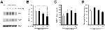 BACE1 Antibody in Western Blot (WB)