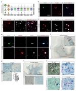 Kallikrein 6 Antibody in Immunocytochemistry, Immunohistochemistry (ICC/IF, IHC)