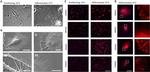 Nephrin Antibody in Immunocytochemistry, Immunohistochemistry (ICC/IF, IHC)