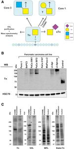 Sialosyl-Tn Antigen Antibody in Western Blot (WB)