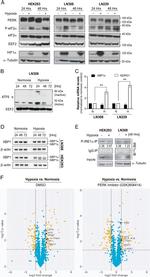 Phospho-IRE1 alpha (Ser724) Antibody in Western Blot, Immunoprecipitation (WB, IP)