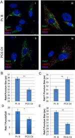 Rab4 Antibody in Immunocytochemistry (ICC/IF)