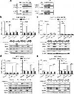 Estrogen Receptor alpha Antibody in Western Blot, Immunoprecipitation (WB, IP)