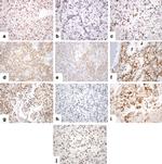 SETD2 Antibody in Immunohistochemistry (Paraffin) (IHC (P))