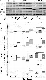 CALCRL Antibody in Western Blot (WB)