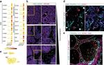 CD326 (EpCAM) Antibody in Immunohistochemistry (IHC)