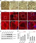 MTCO1 Antibody in Immunohistochemistry (Frozen) (IHC (F))