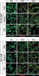 Vimentin Antibody in Immunocytochemistry (ICC/IF)