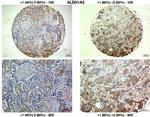 ALDH1A3 Antibody in Immunohistochemistry (IHC)