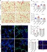 Ki-67 Antibody in Immunocytochemistry, Immunohistochemistry (ICC/IF, IHC)