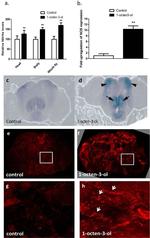 Nitrotyrosine Antibody in Immunohistochemistry (IHC)