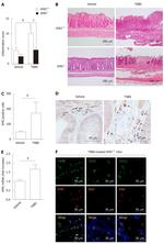 CD19 Antibody in Immunohistochemistry (IHC)