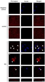 alpha Synuclein Antibody in Proximity Ligation Assay (PLA) (PLA)