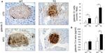 Galectin 3 Antibody in Immunohistochemistry (IHC)