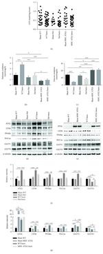 ATGL Antibody in Western Blot (WB)