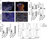 FOXP3 Antibody in Immunohistochemistry (IHC)