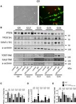 FAK Antibody in Western Blot (WB)