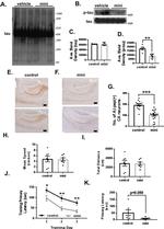 Phospho-Tau (Ser202, Thr205) Antibody in Western Blot (WB)