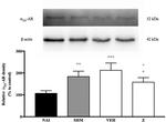 alpha-2a Adrenergic Receptor Antibody in Western Blot (WB)