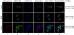 CYP2E1 Antibody in Immunocytochemistry, Immunohistochemistry (ICC/IF, IHC)