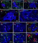 Connexin 32 Antibody in Immunohistochemistry (IHC)