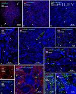 Connexin 32 Antibody in Immunohistochemistry (IHC)