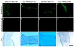 Borrelia burgdorferi Antibody in Immunohistochemistry (IHC)