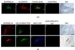 Helicobacter pylori Antibody in Immunohistochemistry (IHC)