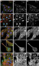 beta Catenin Antibody in Immunocytochemistry, Immunohistochemistry (ICC/IF, IHC)