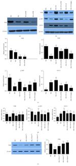 Phospho-AKT1 (Ser473) Antibody in Western Blot (WB)