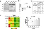 PSMB5 Antibody in Western Blot (WB)