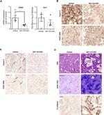 E-cadherin Antibody in Immunohistochemistry (IHC)