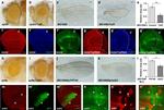 beta Galactosidase Antibody in Immunohistochemistry (IHC)