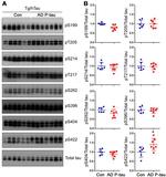 Phospho-Tau (Ser396) Antibody in Western Blot (WB)