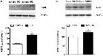 ADORA2A Antibody in Western Blot (WB)