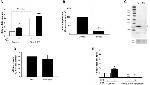 STMN2 Antibody in Western Blot (WB)