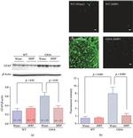 GFAP Antibody in Immunocytochemistry (ICC/IF)