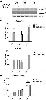 Caspase 7 Antibody in Western Blot (WB)